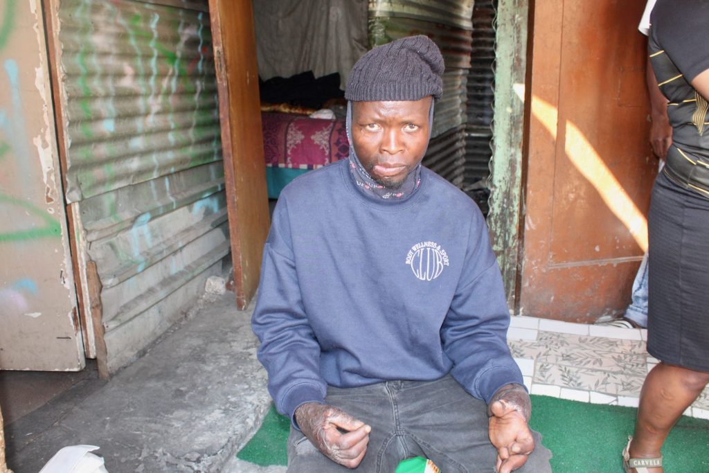 Residents of JHB's 'dark buildings' fear for their lives after deadly fire - Vimarsana News