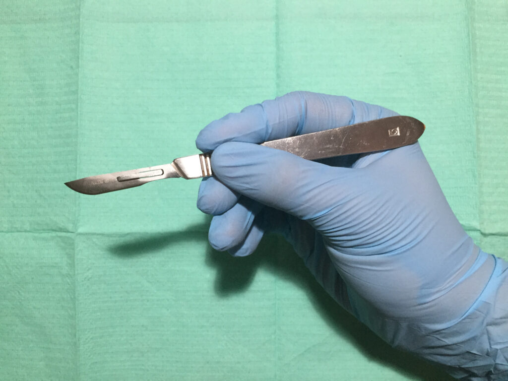 High court sets aside national tender for circumcision device