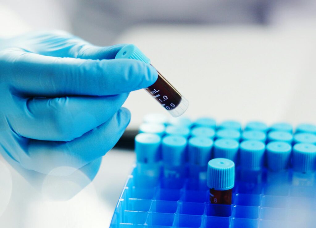 Africa has the world’s greatest genetic diversity
