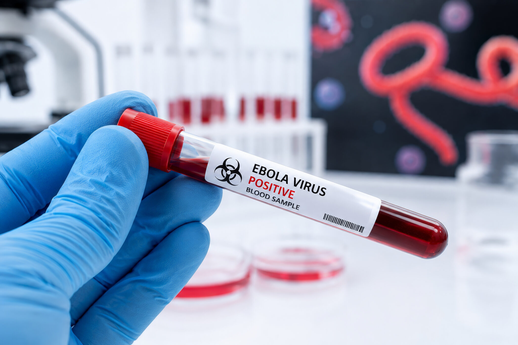 Why Congo’s record Ebola outbreak is becoming deadlier